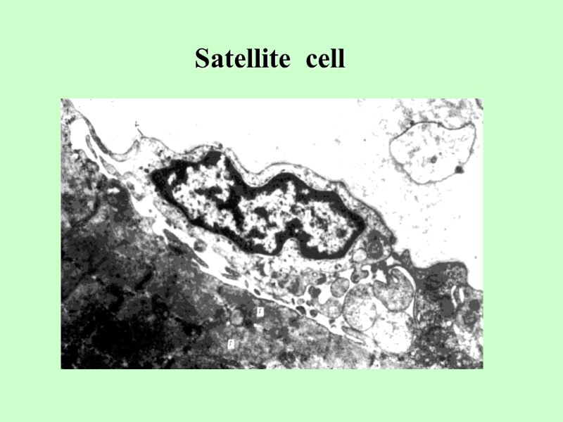 Satellite  cell